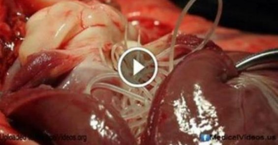 აი რა შეიძლება მოხდეს ორგანიზმის შიგნით, მას მერე რაც ღორის ხორცს მივირთმევთ (სამედიცინო ვიდეო)