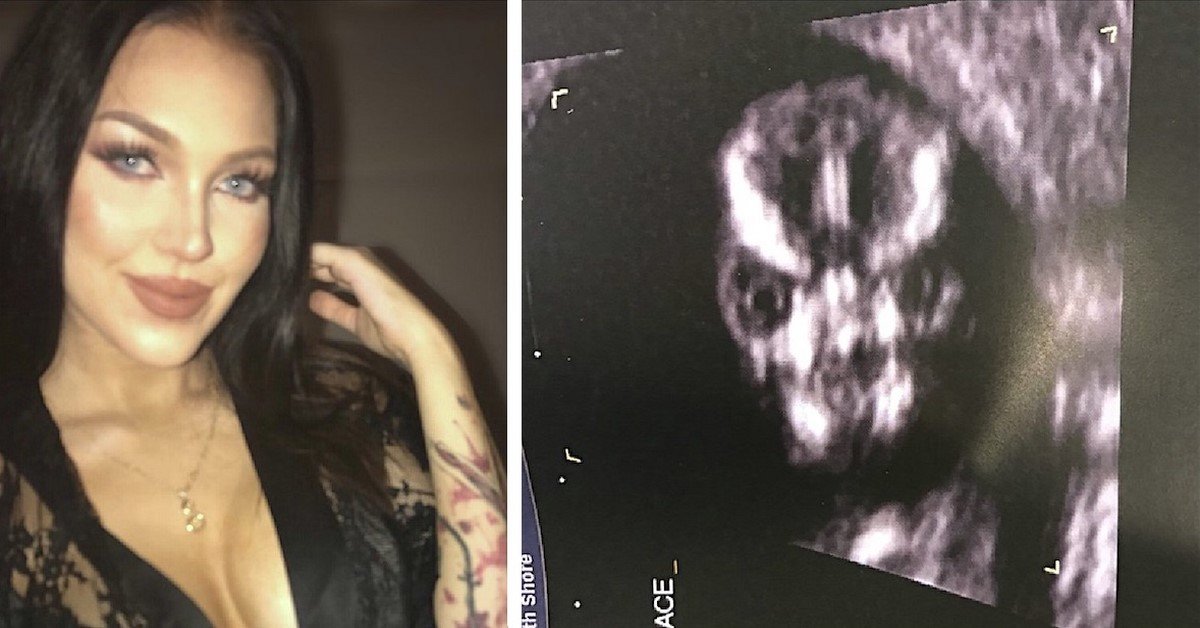 ორსულობის მე-13 კვირას ქალმა ექოსკოპია გაიკეთა. როდესაც ექიმმა მას ფოტოები აჩვენა, საწყალმა კინაღამ შეჰკივლა...
