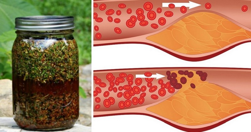 კამა, თაფლი და ვალერიანი! მხოლოდ 1 ს.კ ეს ნაყენი სასწაულმოქმედია თქვენი სისხლძარღვებისთვის.