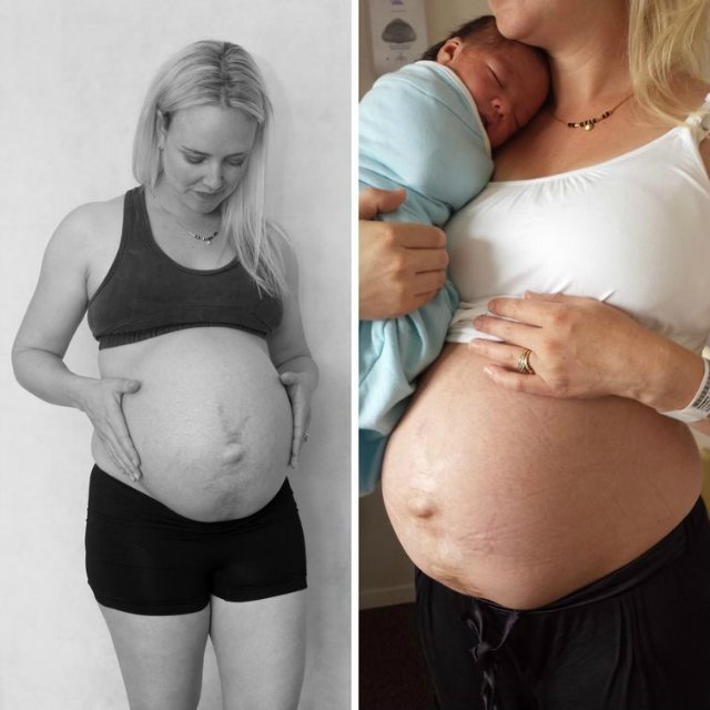 ეს ქალბატონი გვიჩვენებს, თუ როგორ შეიცვალა მისი სხეული მშობიარობიდან 2 კვირის შემდეგ