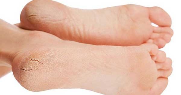 10 გამაფრთხილებელი ნიშანი, რომელსაც ჩვენი ფეხის ტერფები გვაძლევს