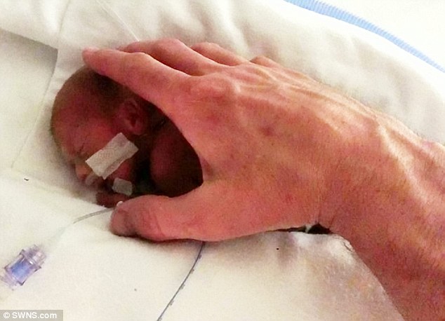 ის 25 კვირის დაიბადა. ექიმების თქმით მას გადარჩენის შანსი არ ჰქონდა, თუმცა სასწაული მოხდა...