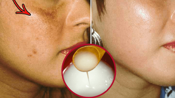 სააფთიაქო იაფფასიანმა ზეთმა კანის მოვლისა და კუჭის სამკურნალო ელიტარულ პრეპარატებს აჯობა! სააფთიაქო იაფფასიანმა ზეთმა კანის მოვლისა და კუჭის სამკურნალო ელიტარულ პრეპარატებს აჯობა!