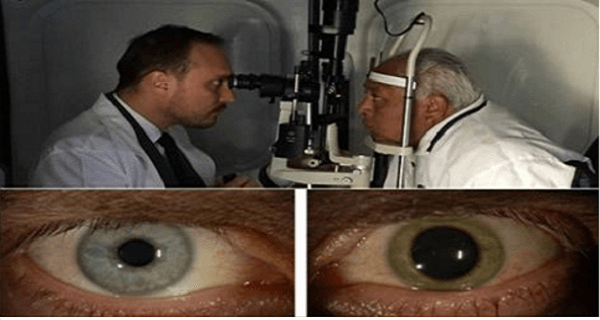 90 წლის ოფტამოლოგი ირწმუნება, რომ მან ამ საშუალებით მხედველობა უამრავ პაციენტს აღუდგინა
