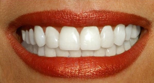შხამიანი კბილები! არხების წმენდა ზრდის ქრონიკული დაავადების რისკს