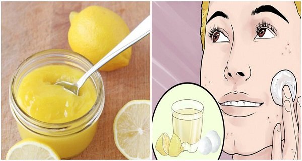 6 რამ, რაც თქვენს სახის კანს ემართება, როდესაც ლიმონის წვენს გამოიყენებთ